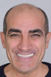 Murat Coskun